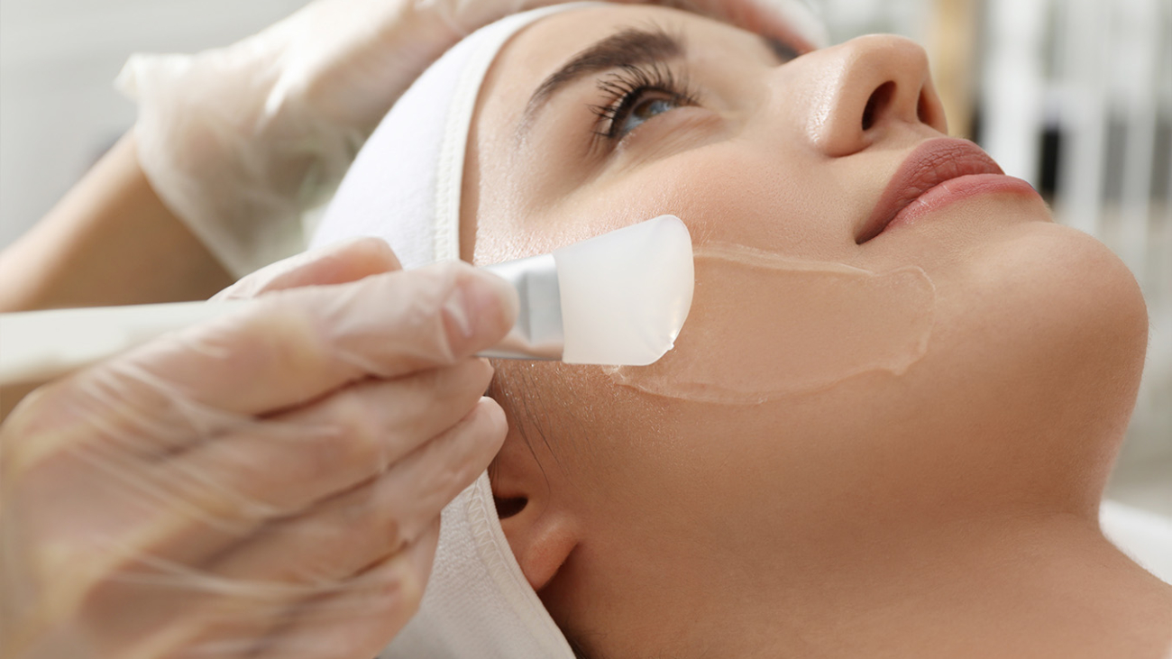 Chemical Peels